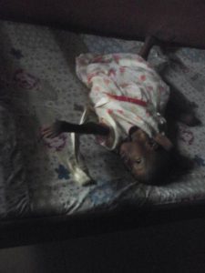 disabled little girl